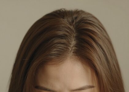 Haarausfall Bei Frauen Erkennen Und Sanft Gegensteuern